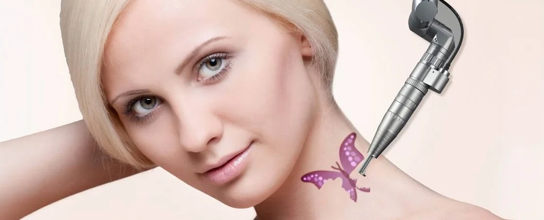 Лазерне видалення тату
