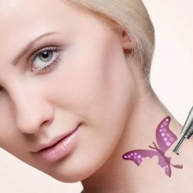 Лазерне видалення татуювання до -25%