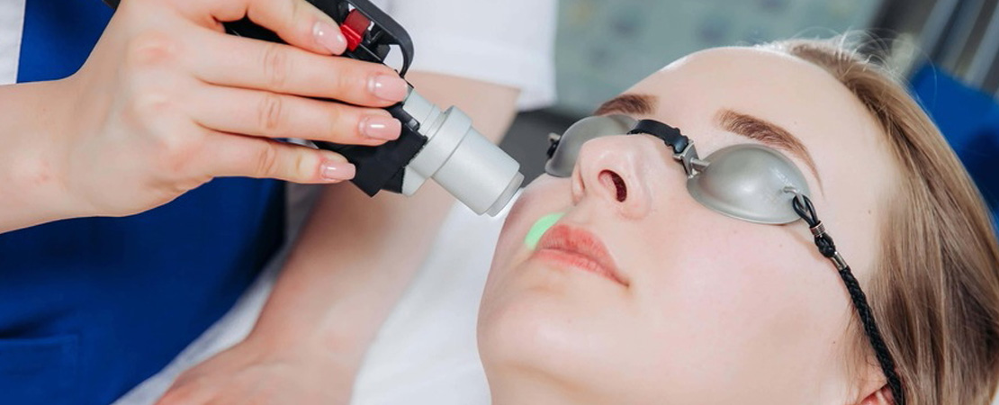 Лазерна епіляція верхньої губи