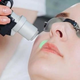 Верхня губа