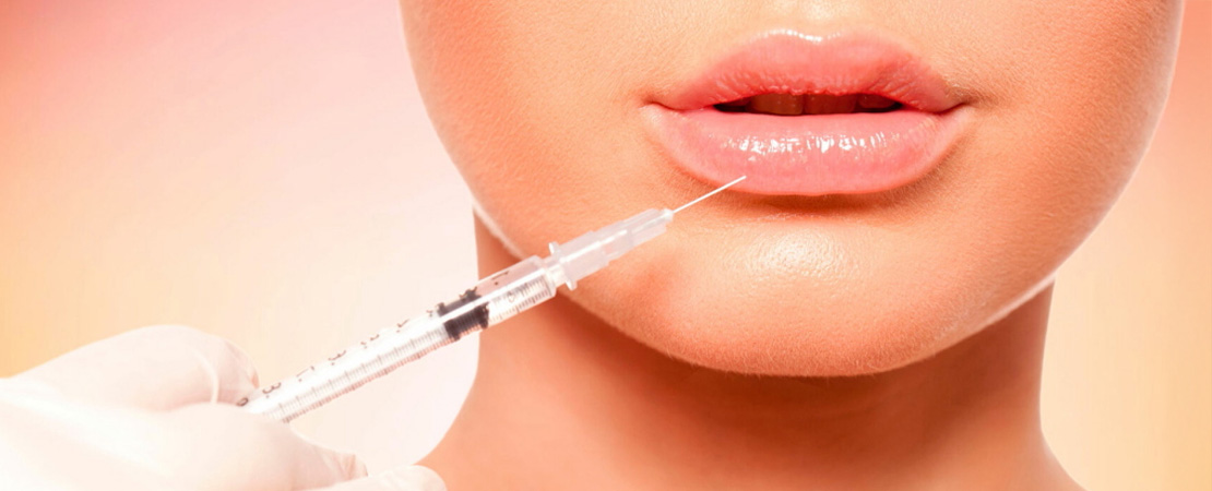 Ліпофілінг губ