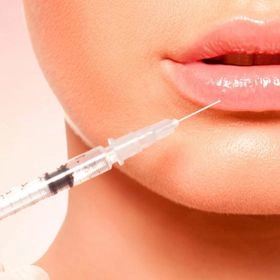 Ліпофілінг губ