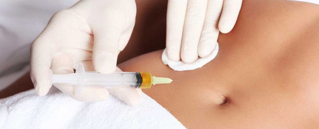 Мезотерапія для тіла