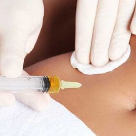 Мезотерапія тіла -10%