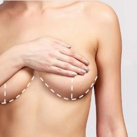 Пластика грудей