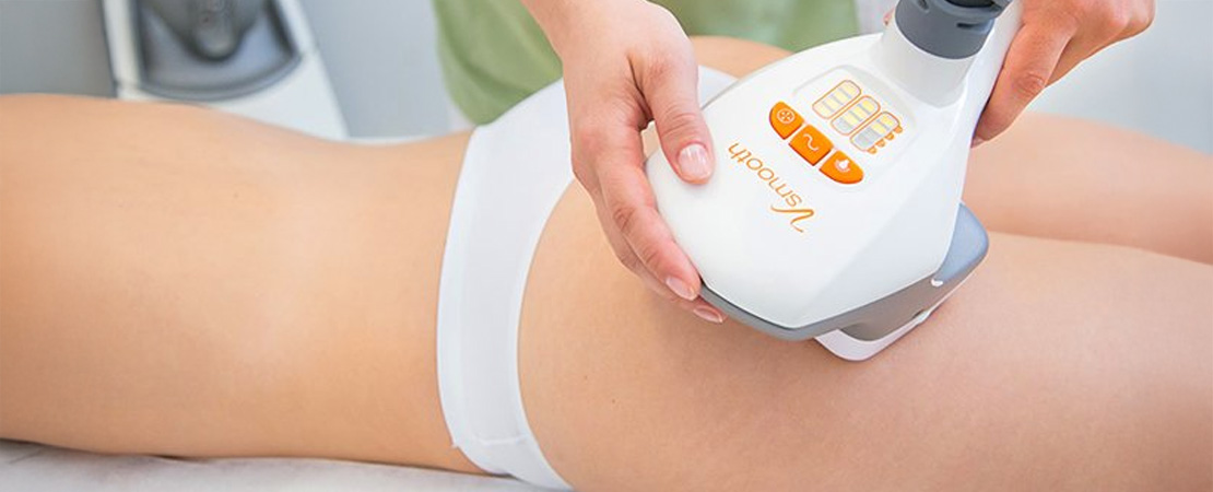 Ліполіз та підтяжка шкіри VelaShape