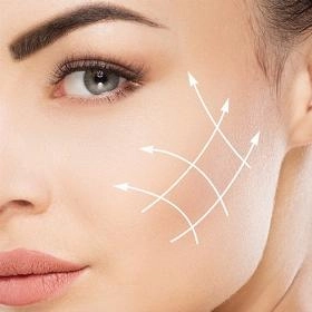 Ліпофілінг вилиць