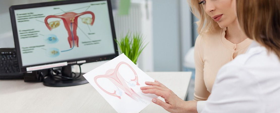 Лазерне лікування опущення піхви та матки