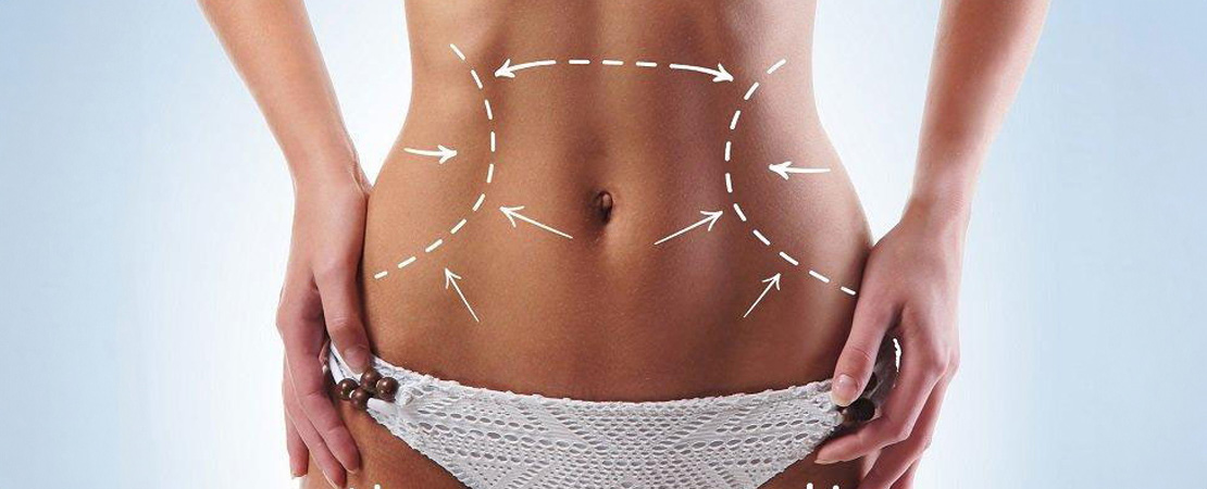 Ультразвуковий SMAS-ліфтинг тіла