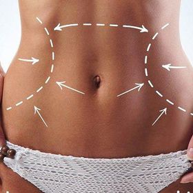 Ультразвуковий SMAS-ліфтинг тіла -50%