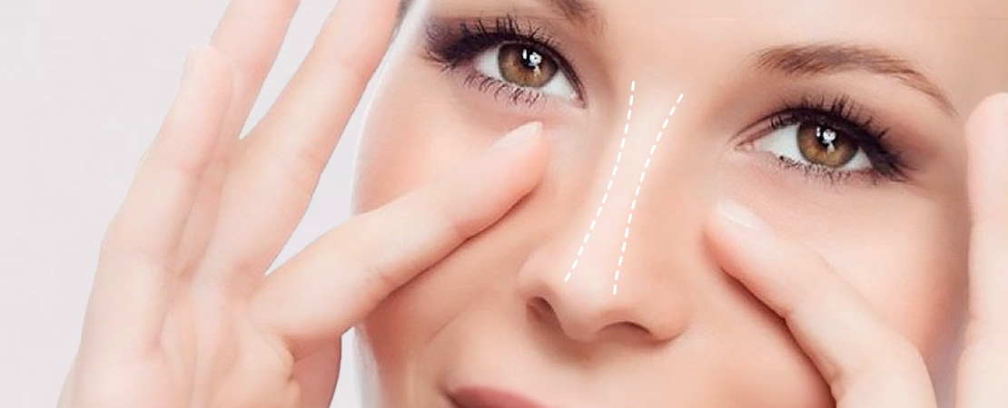 Септопластика (пластика носової перегородки)