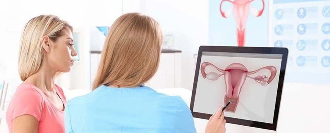 Конізація шийки матки