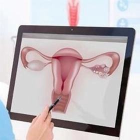 Конізація шийки матки