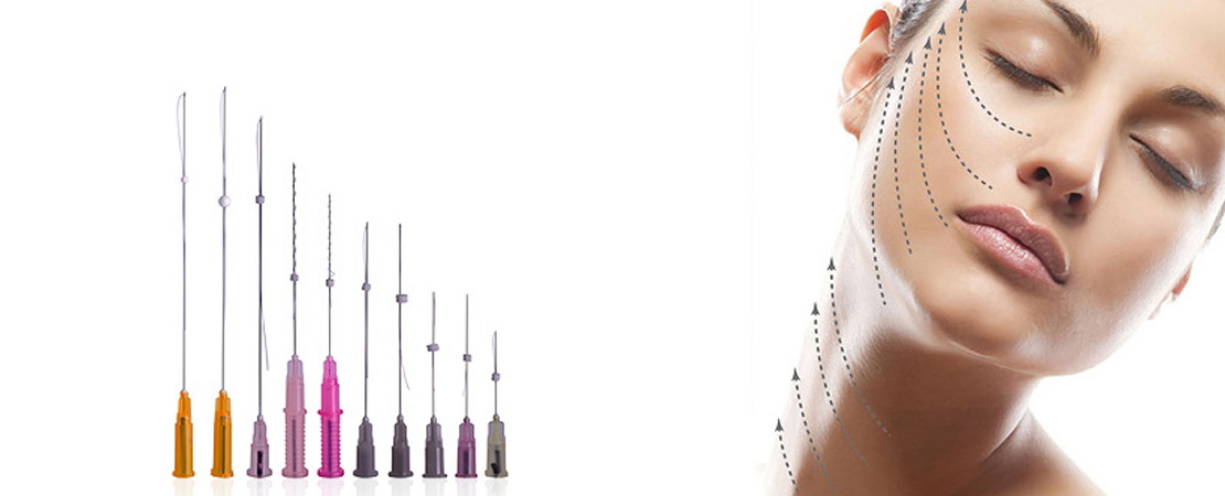 Мезоніті 3D (тредліфтинг)