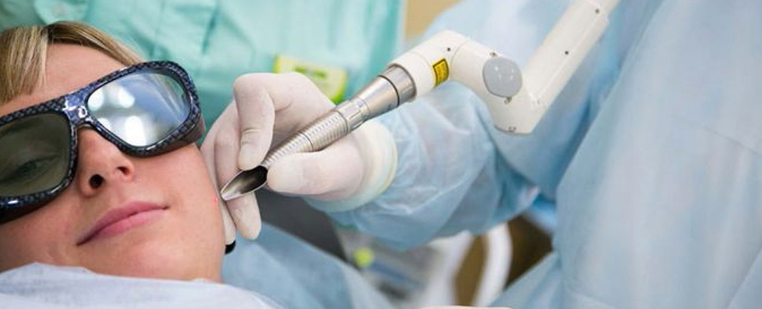 Лазерное удаление папиллом