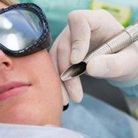 Лазерне видалення папілом 