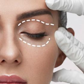 Блефаропластика до -20%