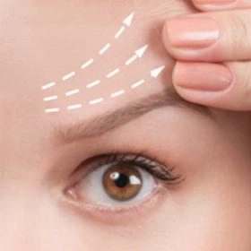 Підтяжка брів