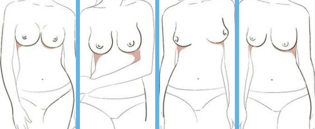 форми грудей у жінок