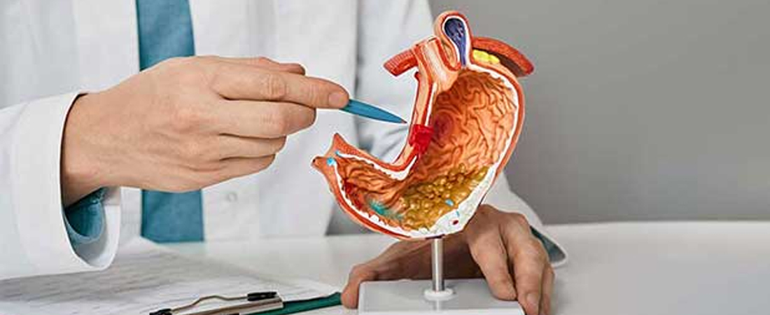 Коли варто турбуватись про ліпому Коли варто турбуватись про лімому