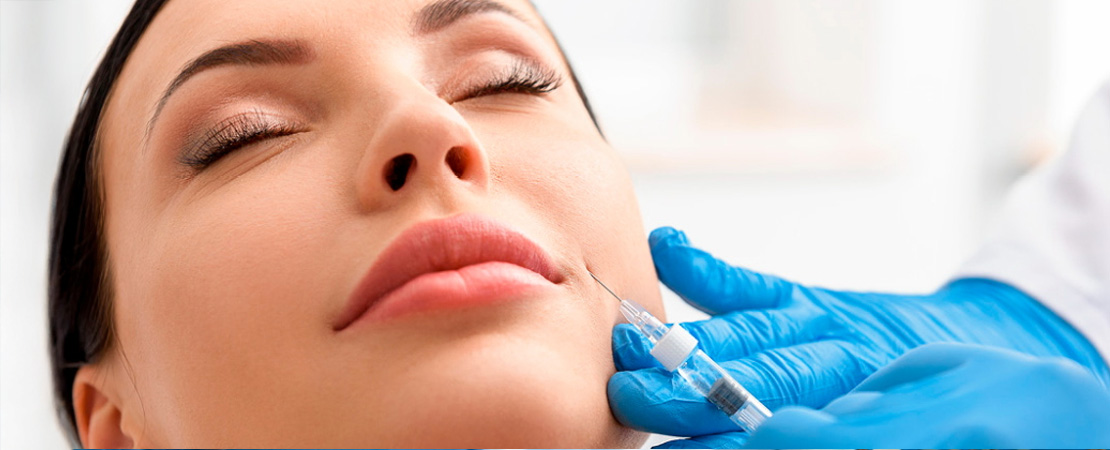 Ліпофілінг носогубних складок