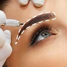 Пересадка брів та бороди 