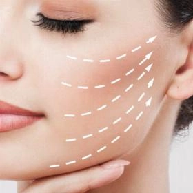 Підтяжка обличчя
