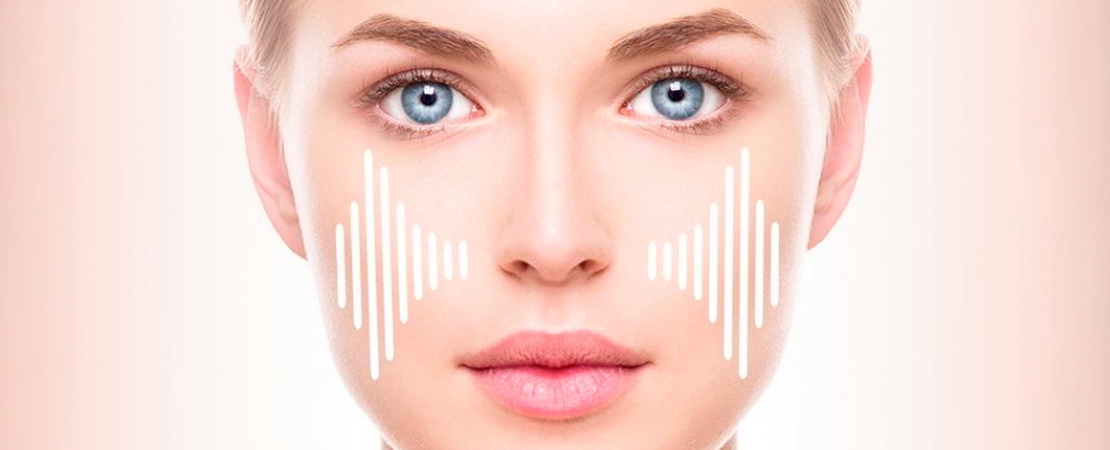 Радіохвильовий RF/РФ ліфтинг обличчя та тіла