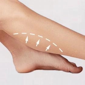 Ліпосакція гомілок