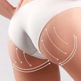 Ліпофілінг