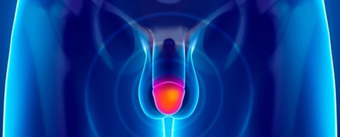 Обрізання крайньої плоті