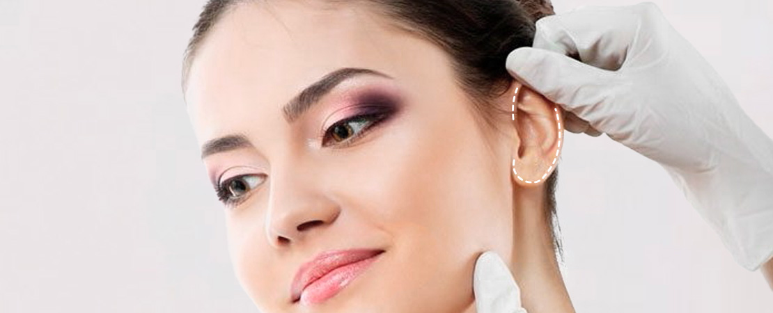 Отопластика в Києві