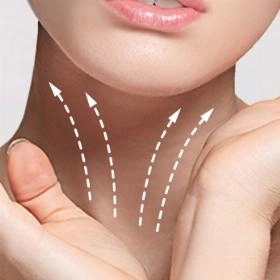 Підтяжка шиї