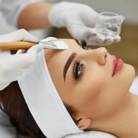 Хімічний пілінг