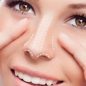 Рінопластика