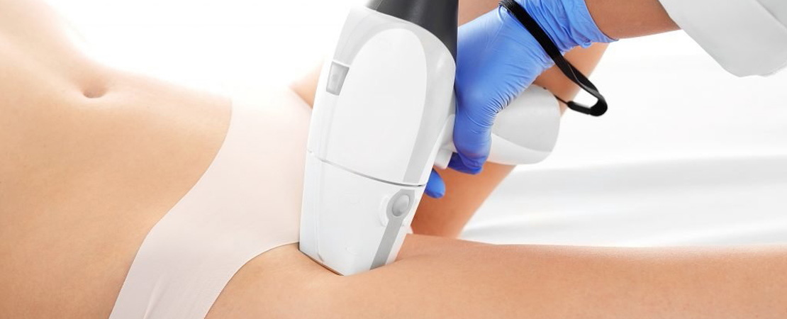 Лазерна епіляція бікіні