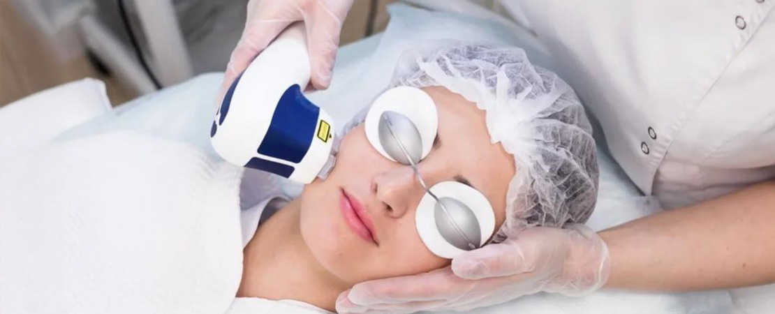 Лазерна епіляція обличчя