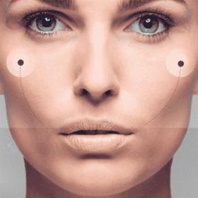 Пластика вилиць до -20%